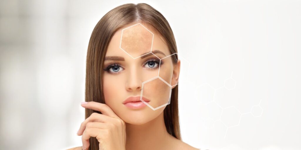 Why Is AHA Best for Skin