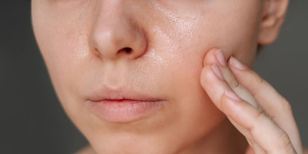 oily skin care in summer