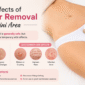Side Effects of Laser Hair Removal on the Bikini Area 85x85